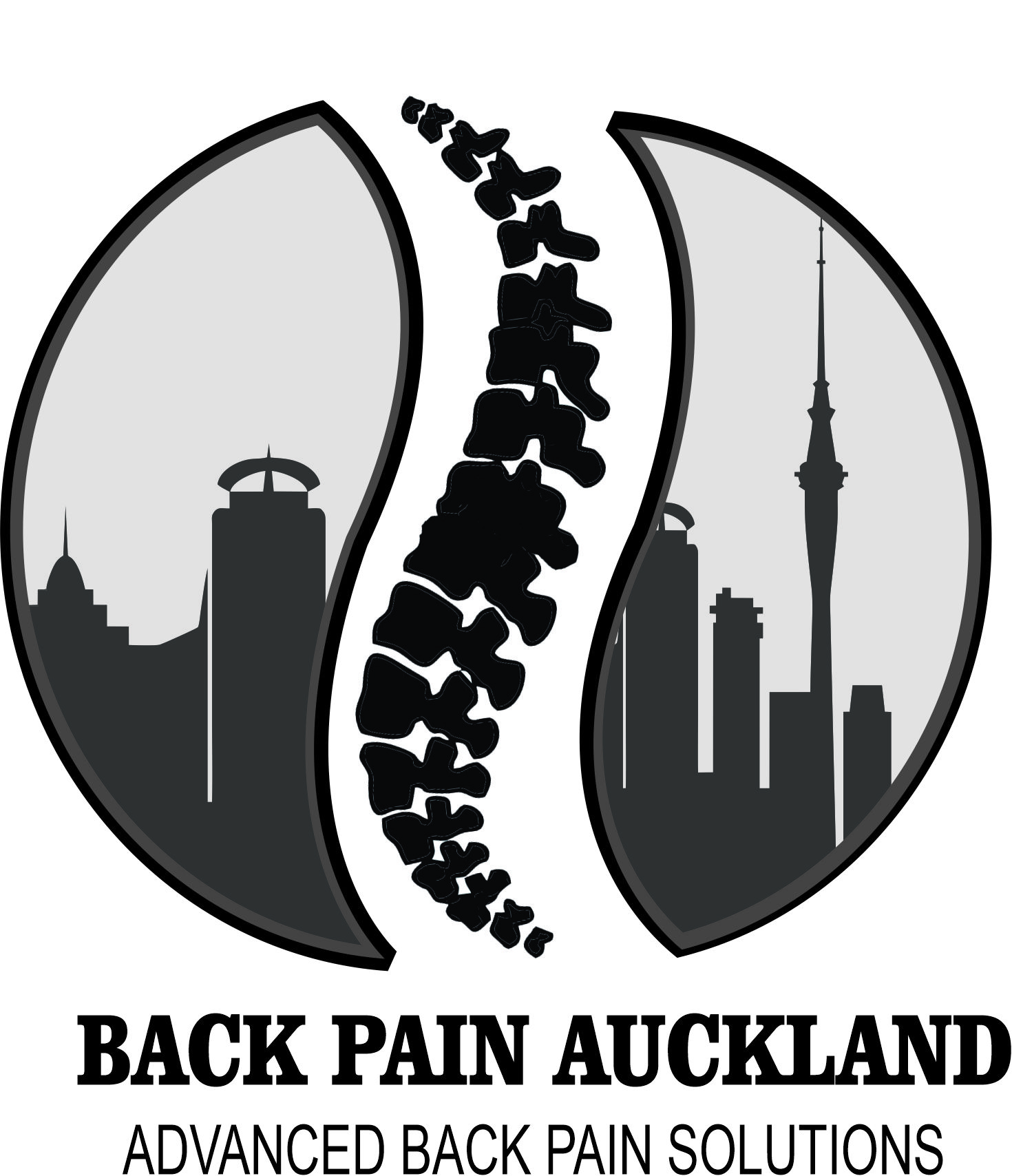 Lower Back Pain Auckland
