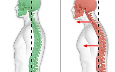 Bad Posture and Lower Back Pain