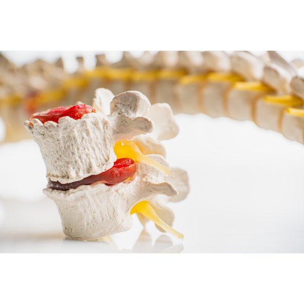 Lower back pain