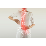 Scoliosis