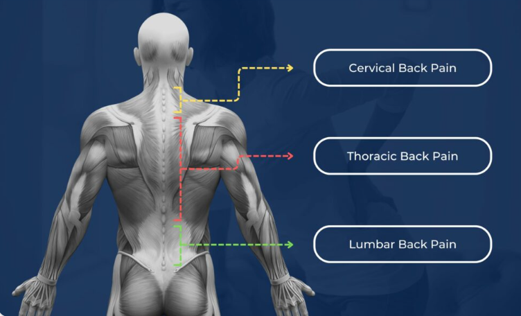 Lower Back Pain Auckland Lower Back Pain